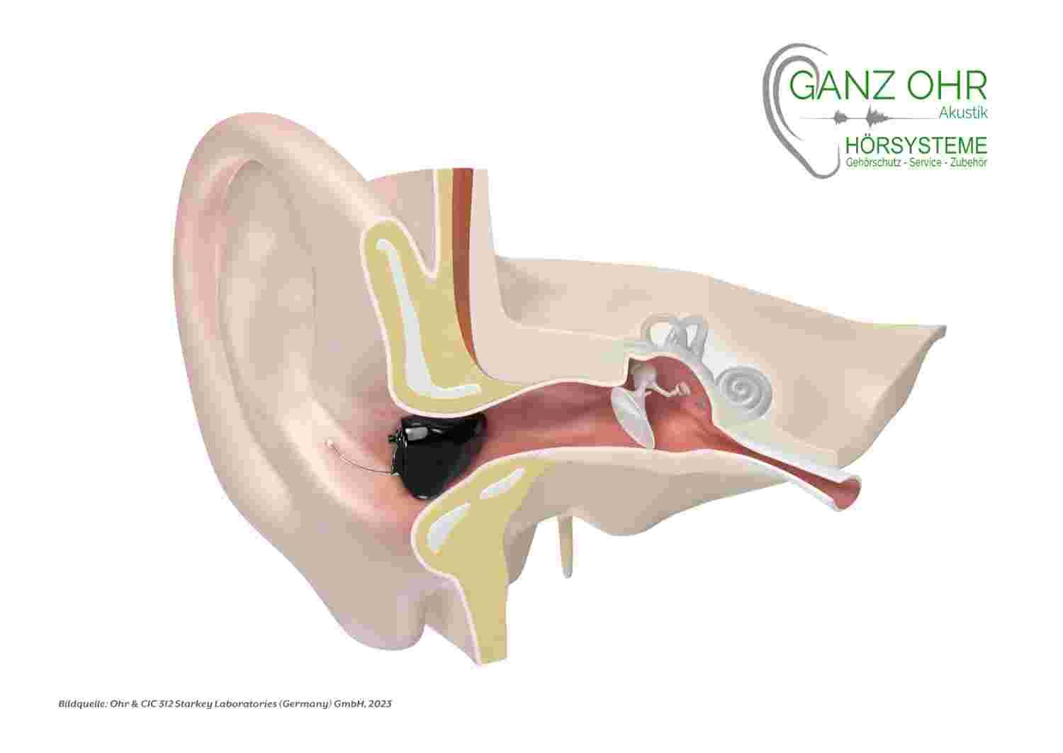 Hörgerät IdO weiß